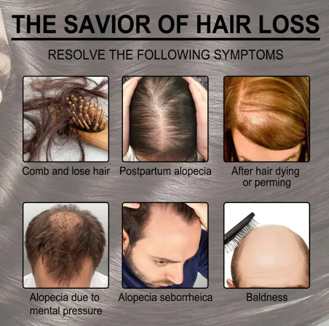 🌿 Huile essentielle de romarin pour les cheveux – Des racines plus fortes, des cheveux plus épais, naturellement 🌿