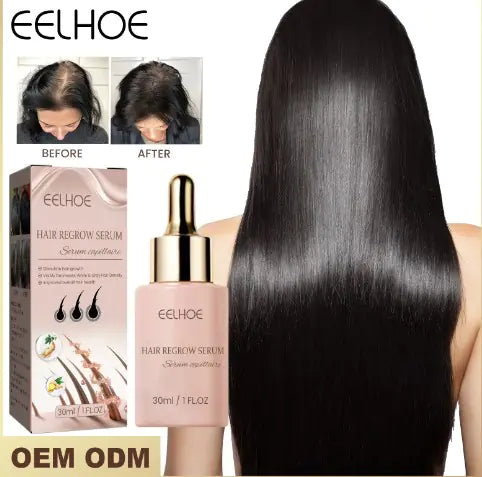 🔥Hair Dense Essence – Thicker, Fuller, Stronger Hair Starts Here🔥