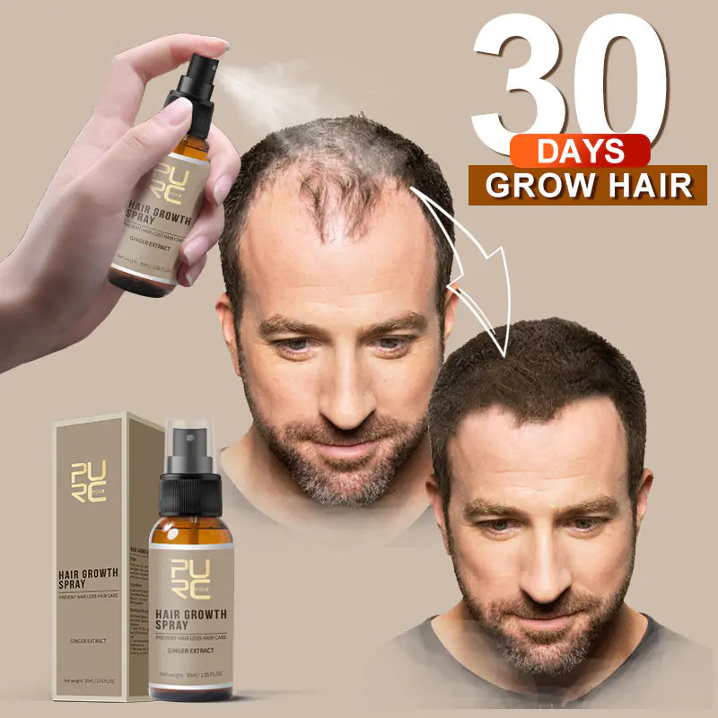 🔥 Hair Growth Spray – Strengthen Roots, Stop Hair Loss Boost Growth 🔥